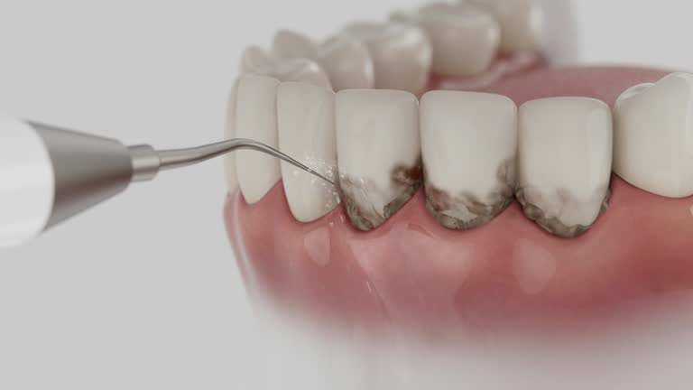 Trusted Tooth Extraction service in Crystal City, TX - Dentist Open Now